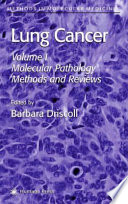 Lung Cancer Volume 1: Molecular Pathology Methods and Reviews / edited by Barbara Driscoll.
