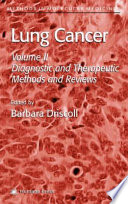 Lung Cancer Volume 2: Diagnostic and Therapeutic Methods and Reviews / edited by Barbara Driscoll.