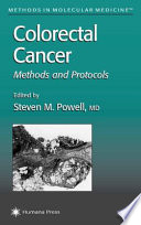 Colorectal Cancer Methods and Protocols / edited by Steven M.