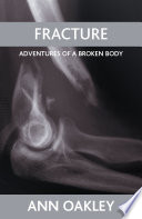 Fracture : adventures of a broken body / Ann Oakley.