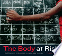 The body at risk : photography of disorder, illness, and healing / Carol Squiers.